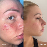 Clinisoothe+ Skin Purifier 250ML