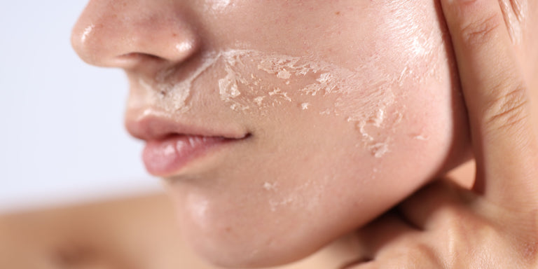 OK! | Simple tips to soothe sensitive, irritated skin this winter – from gentle cleansers to calming creams
