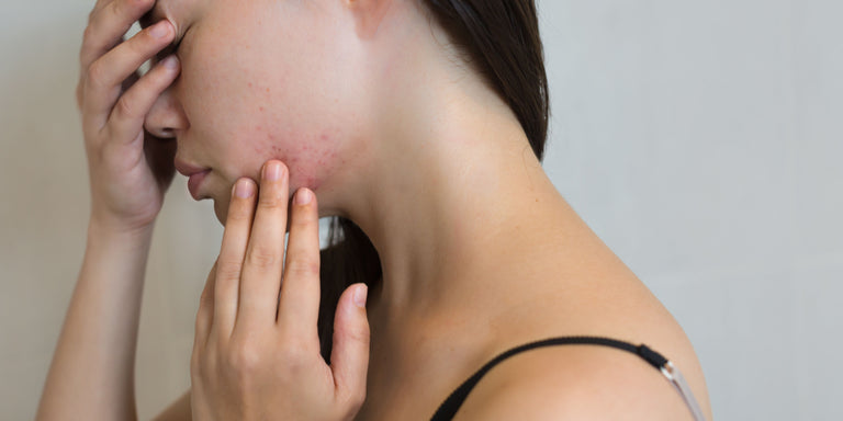 WOMAN AND HOME | Skin Stresses
