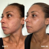 Clinisoothe+ Skin Purifier 100ML